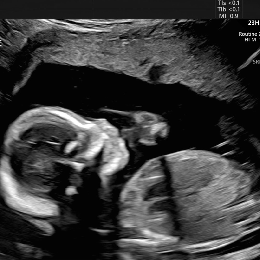 Photo shared by Jameka for their Babylist baby registry.