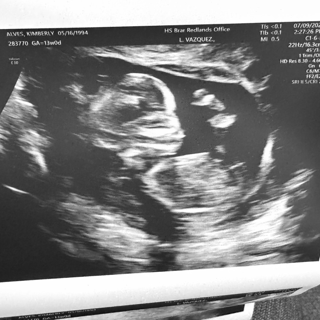 Photo shared by Kimberly for their Babylist baby registry.