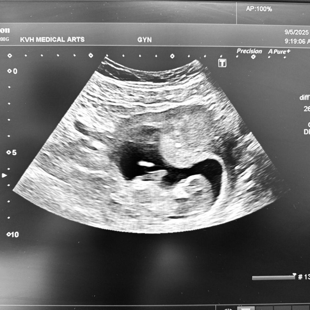 Photo shared by Amber for their Babylist baby registry.