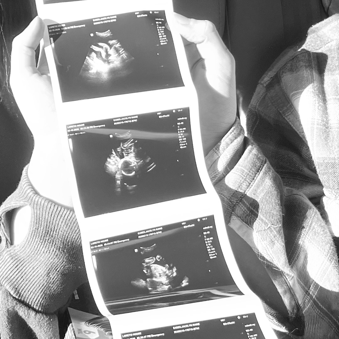 Photo shared by Jacelyn for their Babylist baby registry.