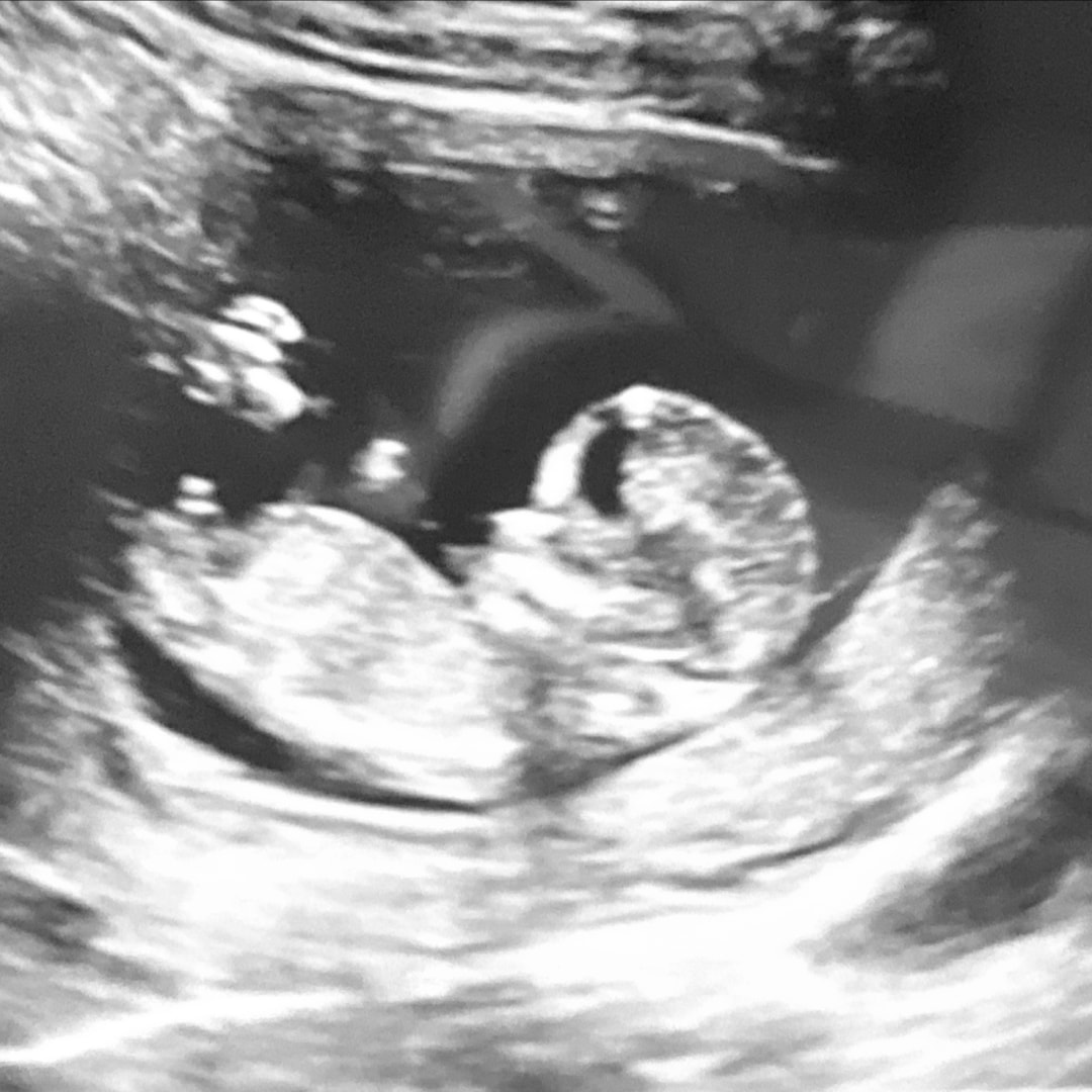 Photo shared by Rachel for their Babylist baby registry.