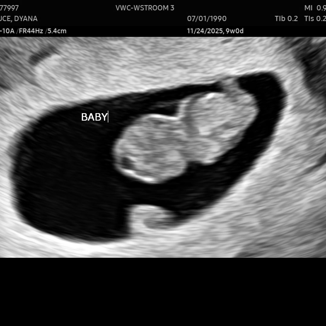 Photo shared by Dyana for their Babylist baby registry.
