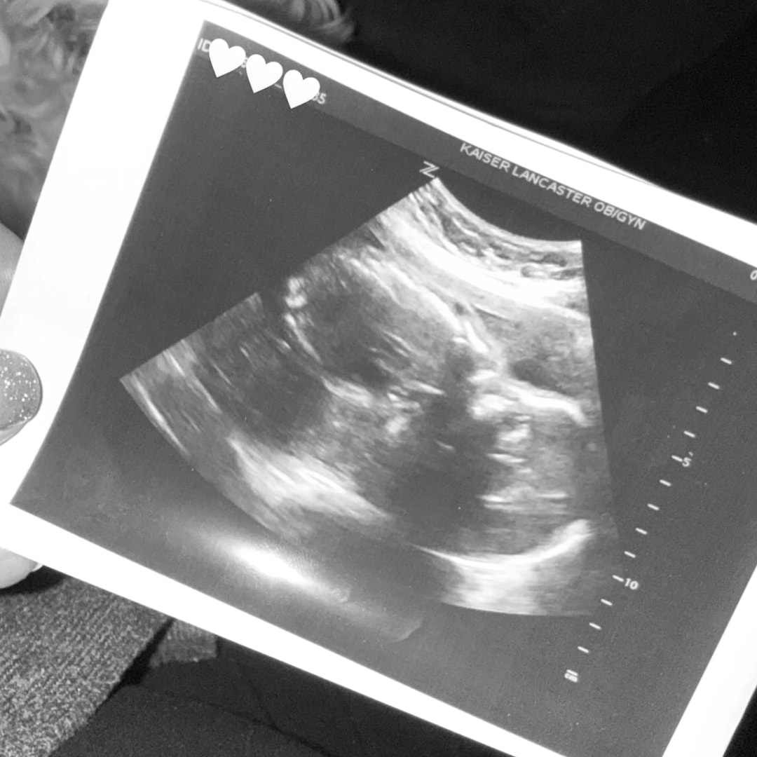 Photo shared by Stephany for their Babylist baby registry.