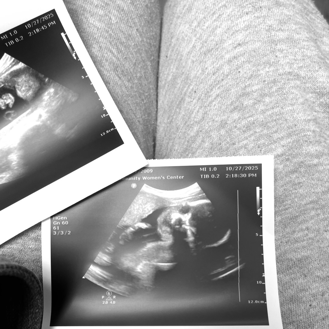 Photo shared by Shanya for their Babylist baby registry.