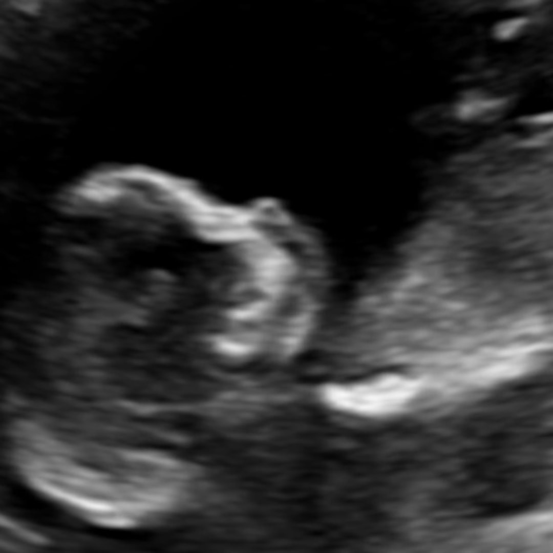 Photo shared by Karen for their Babylist baby registry.