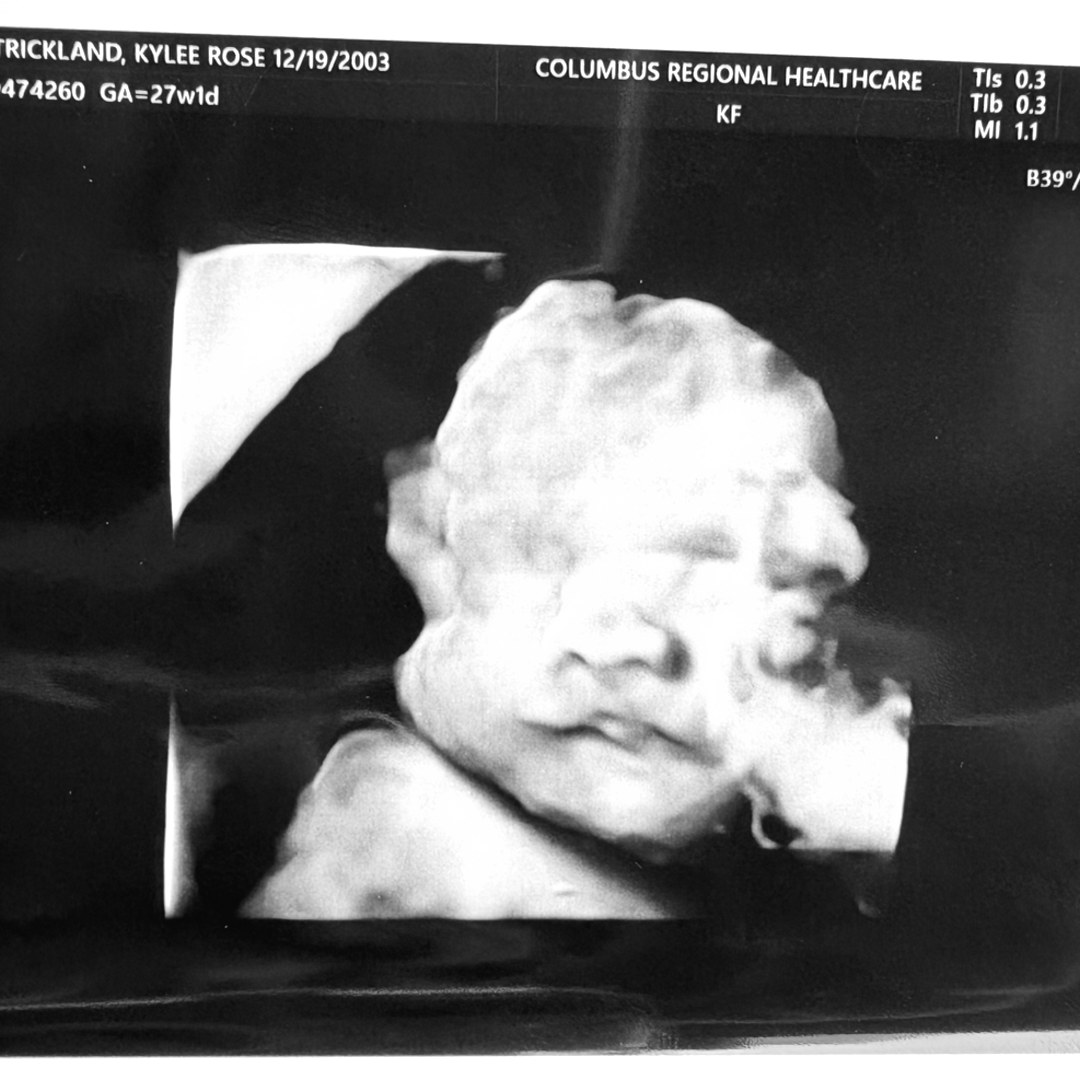 Photo shared by Kylee for their Babylist baby registry.