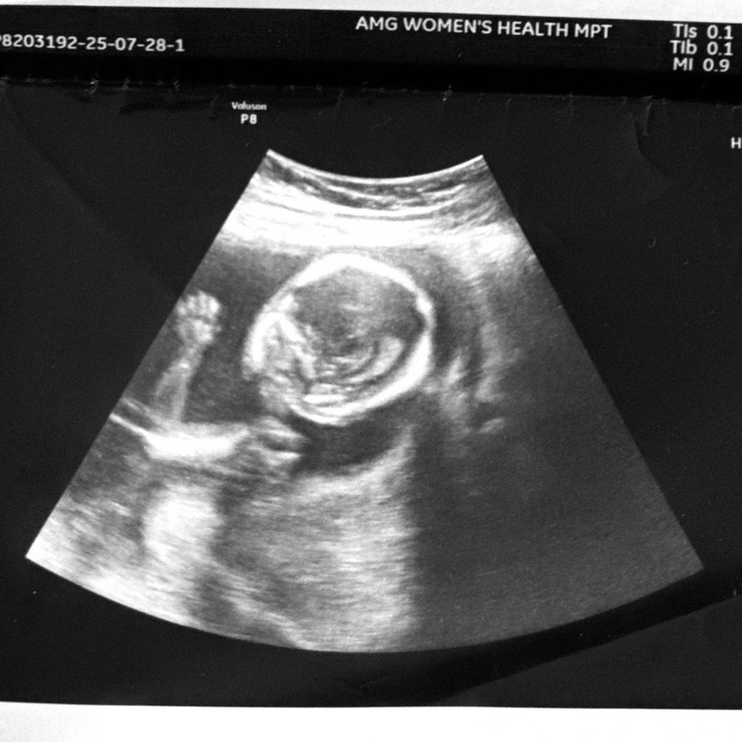 Photo shared by Briana for their Babylist baby registry.