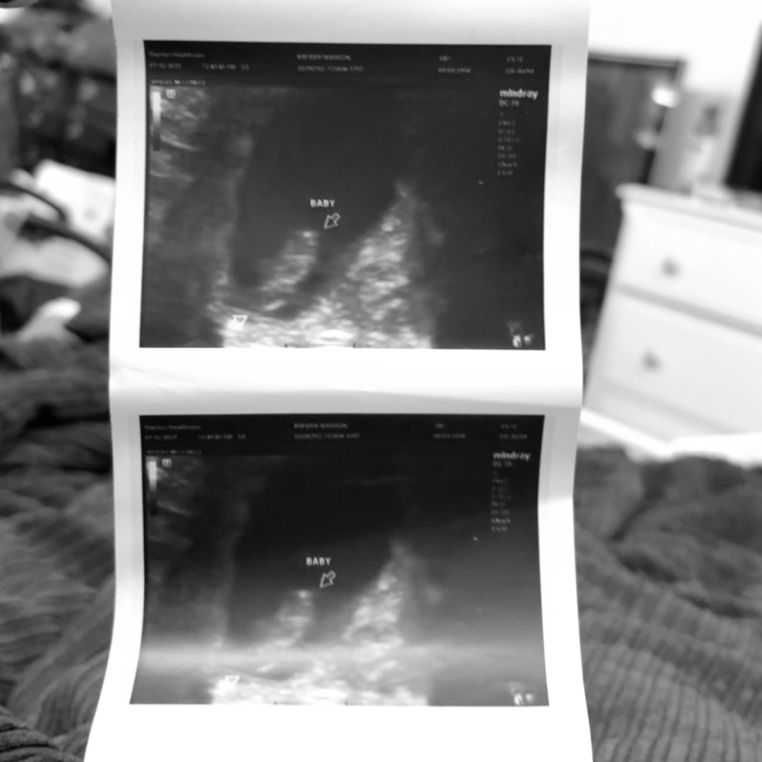 Photo shared by Maddy for their Babylist baby registry.