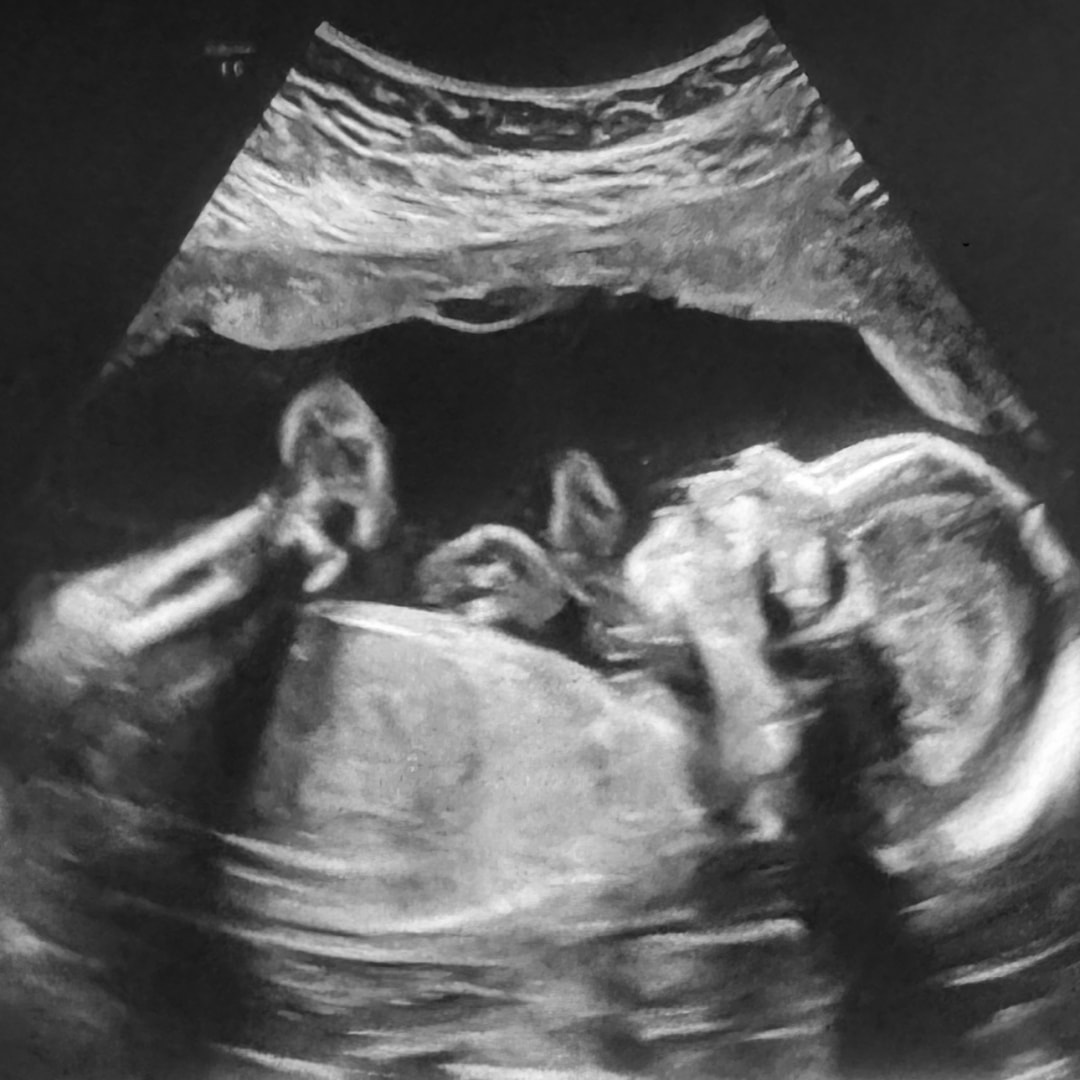 Photo shared by Jordan for their Babylist baby registry.