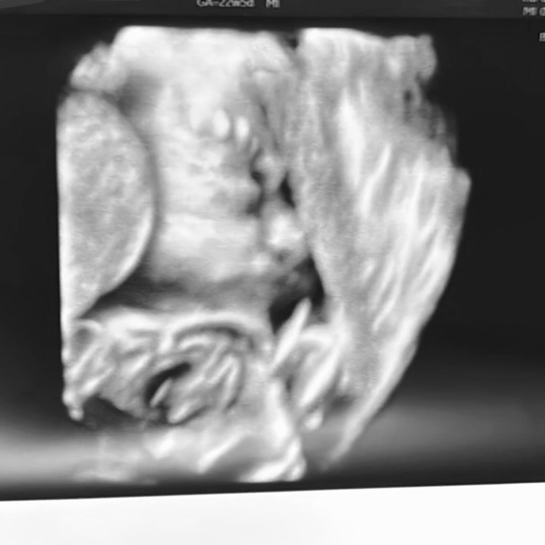 Photo shared by Carlianne for their Babylist baby registry.
