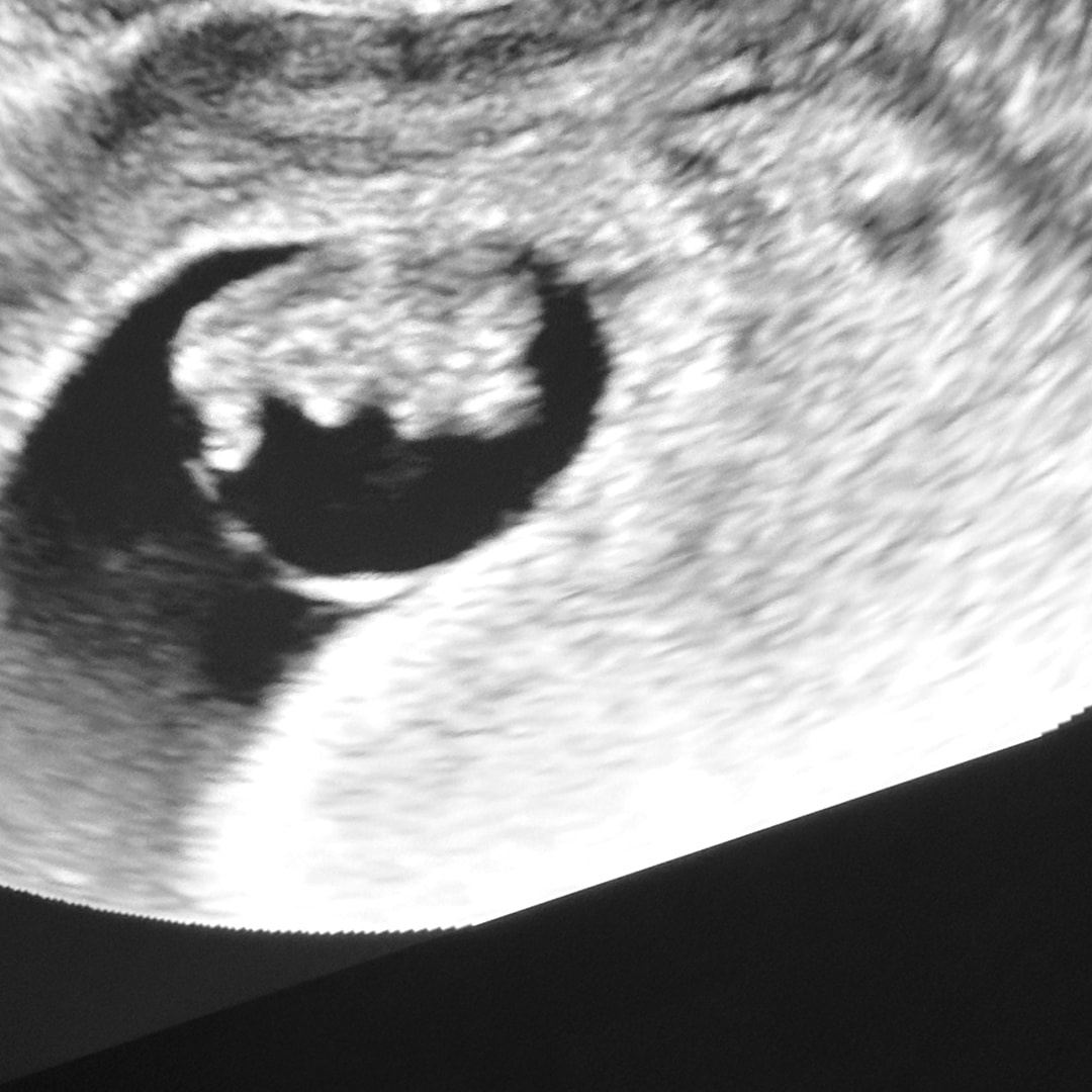 Photo shared by Savannah for their Babylist baby registry.