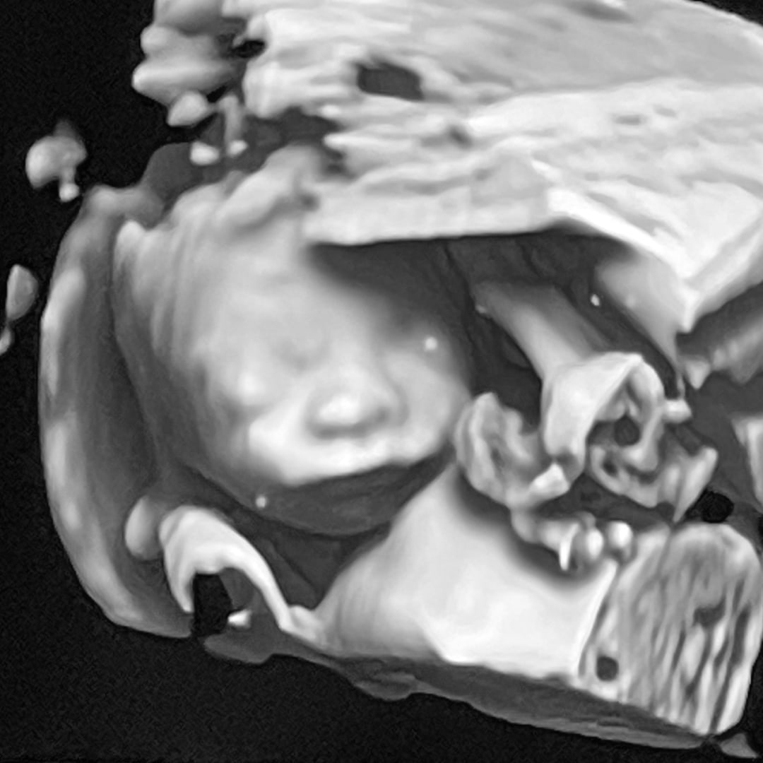 Photo shared by Sierra for their Babylist baby registry.