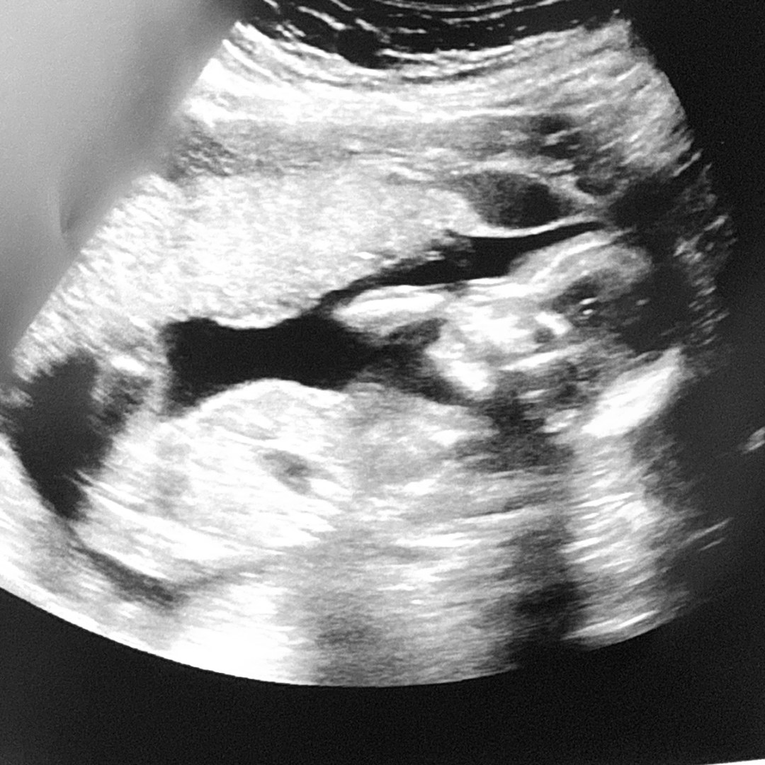 Photo shared by Joslynn for their Babylist baby registry.