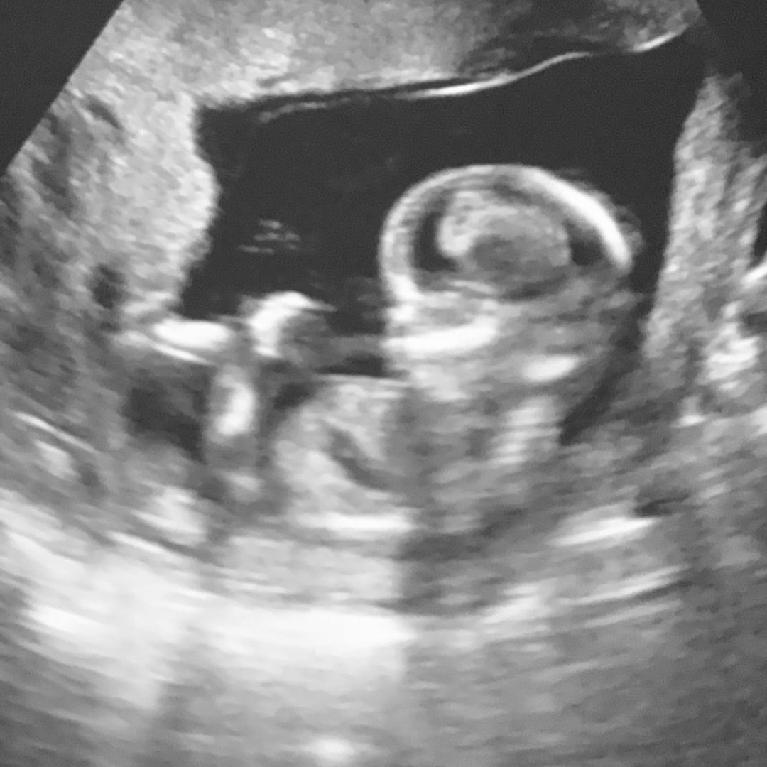 Photo shared by Christianna for their Babylist baby registry.