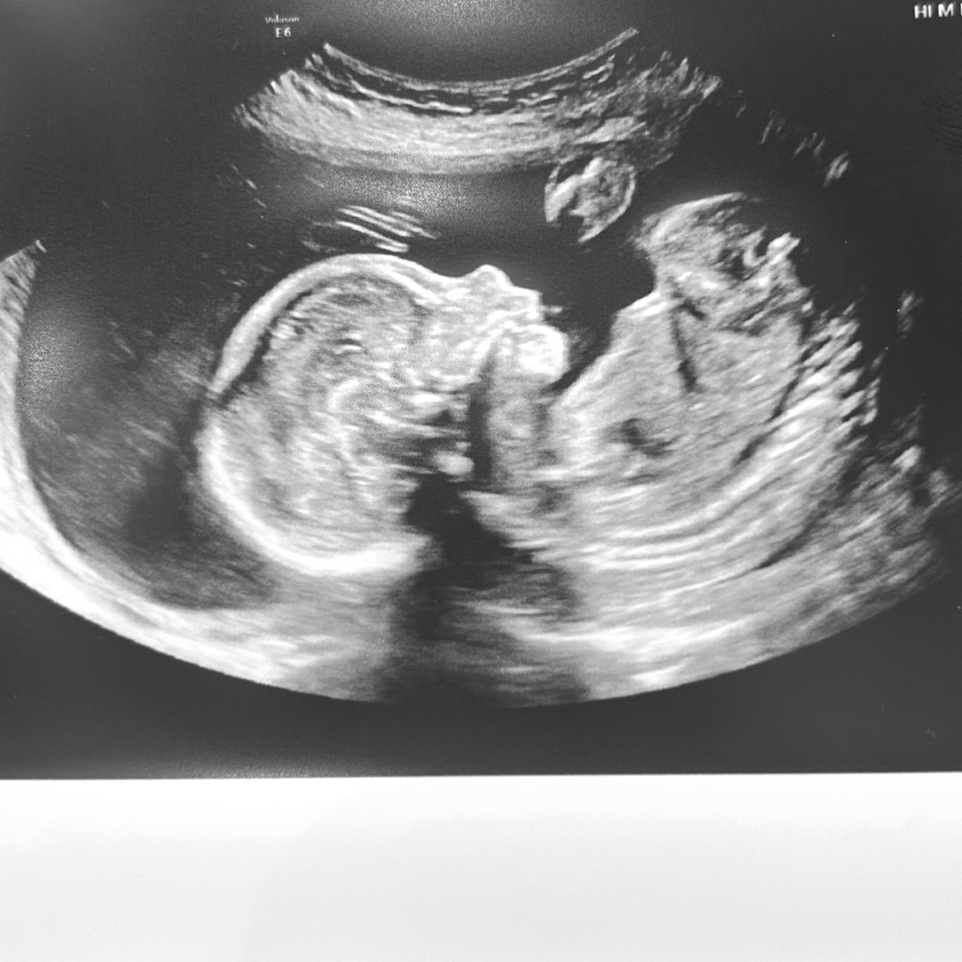 Photo shared by Abigail for their Babylist baby registry.