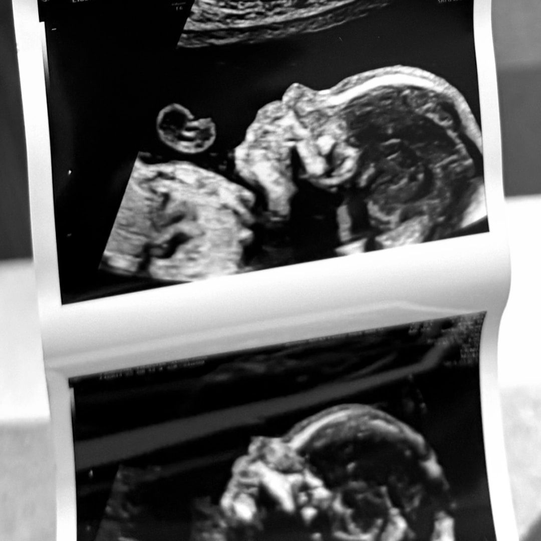 Photo shared by Taiya for their Babylist baby registry.