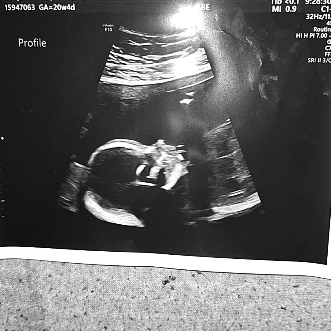 Photo shared by Jessica for their Babylist baby registry.