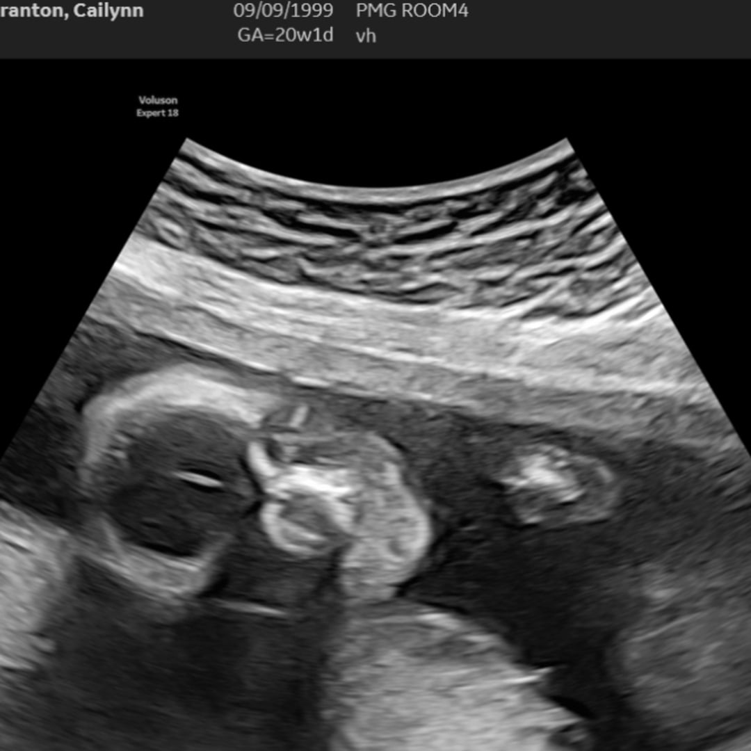 Photo shared by Cailynn for their Babylist baby registry.