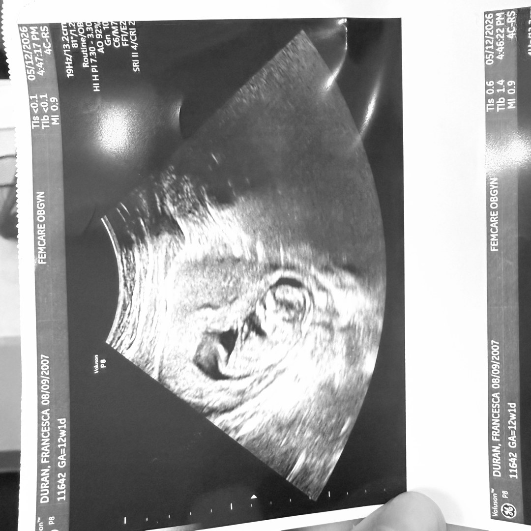 Photo shared by Francesca for their Babylist baby registry.