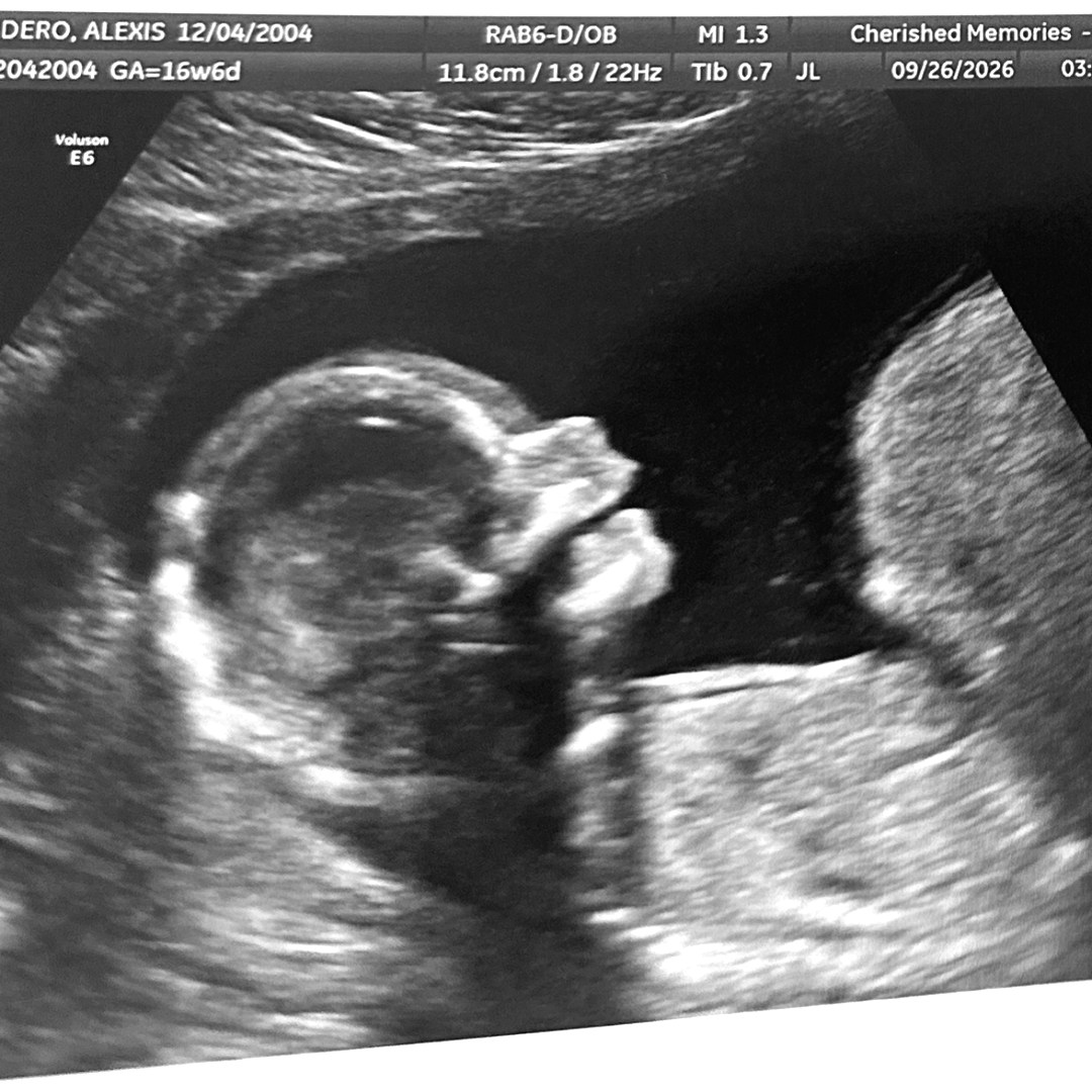 Photo shared by Alexis for their Babylist baby registry.