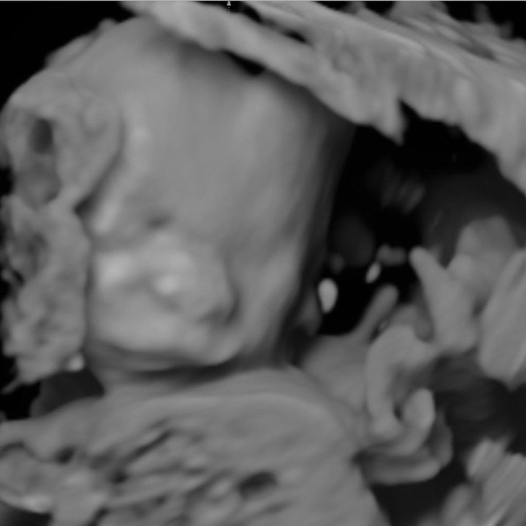 Photo shared by Lily for their Babylist baby registry.
