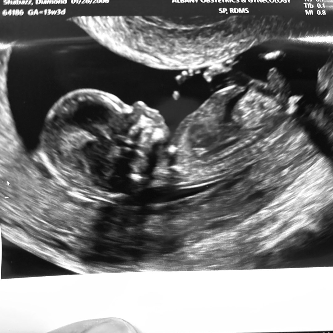 Photo shared by Dymond for their Babylist baby registry.