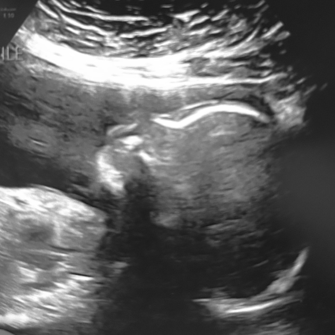 Photo shared by Emma for their Babylist baby registry.