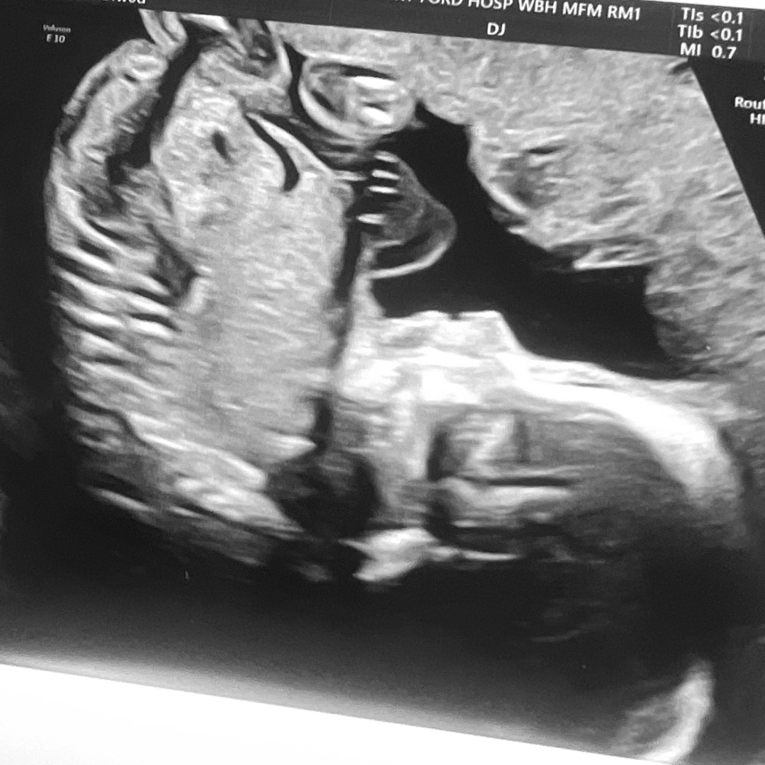 Photo shared by Corryn for their Babylist baby registry.