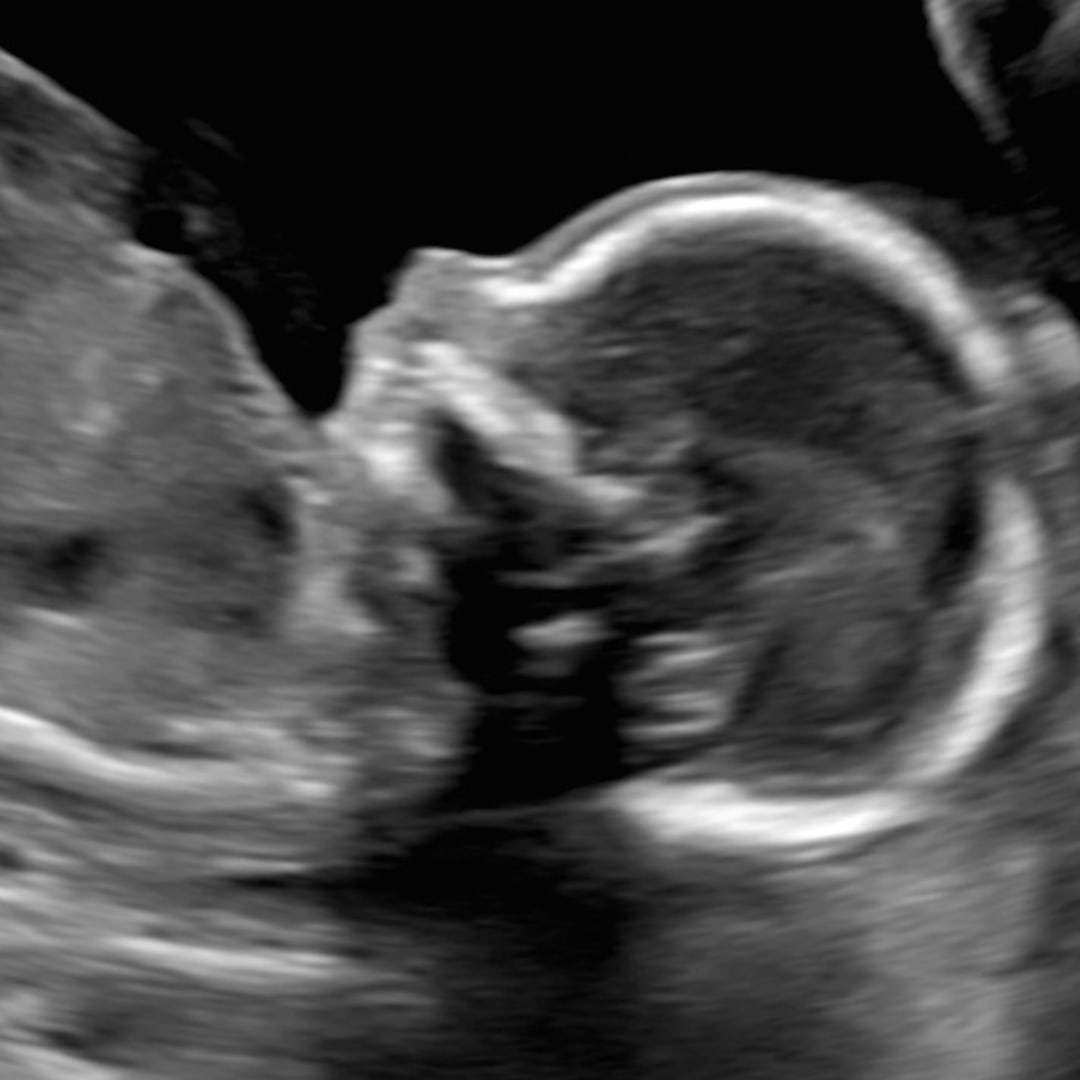 Photo shared by Brianna for their Babylist baby registry.