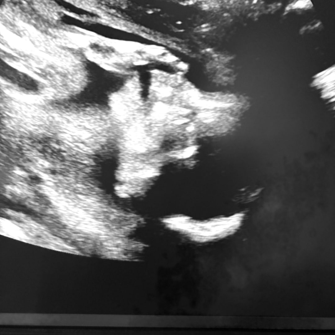 Photo shared by Abby for their Babylist baby registry.