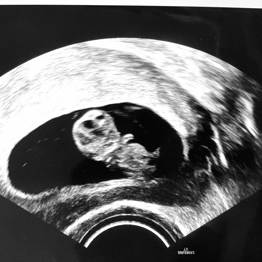 Photo shared by Alyssa for their Babylist baby registry.