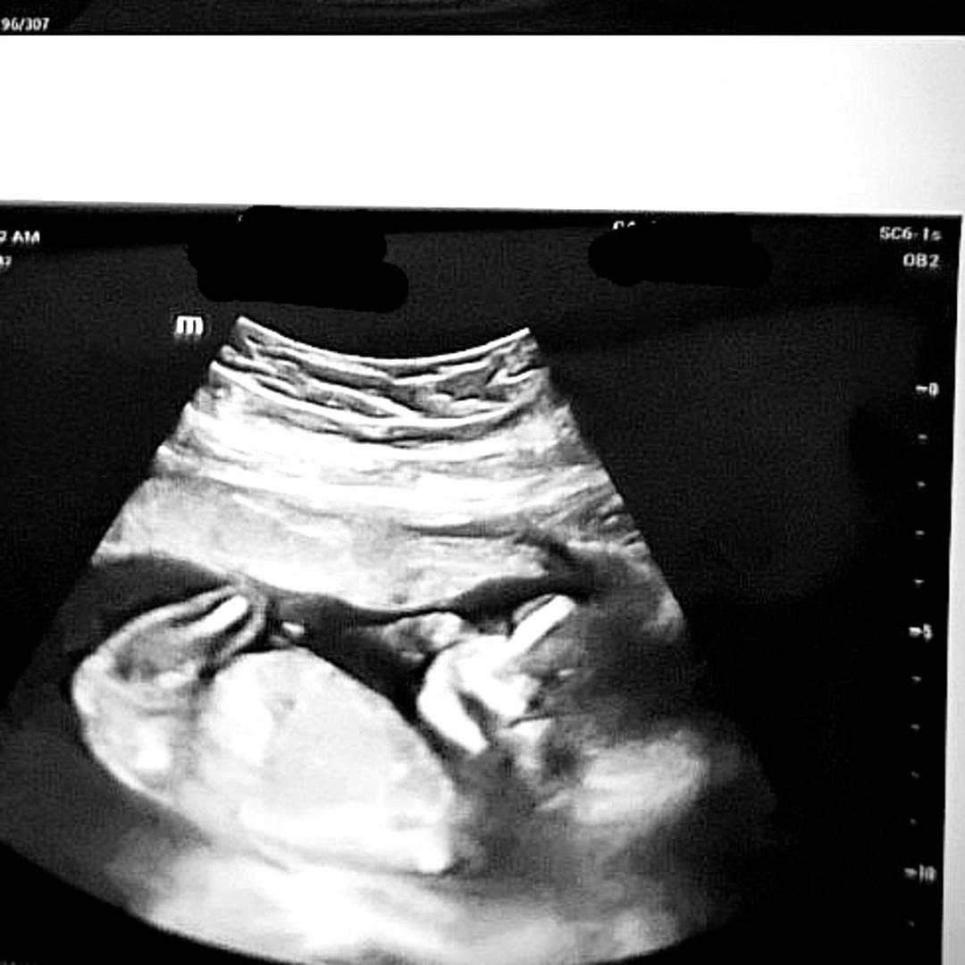 Photo shared by Brynn for their Babylist baby registry.