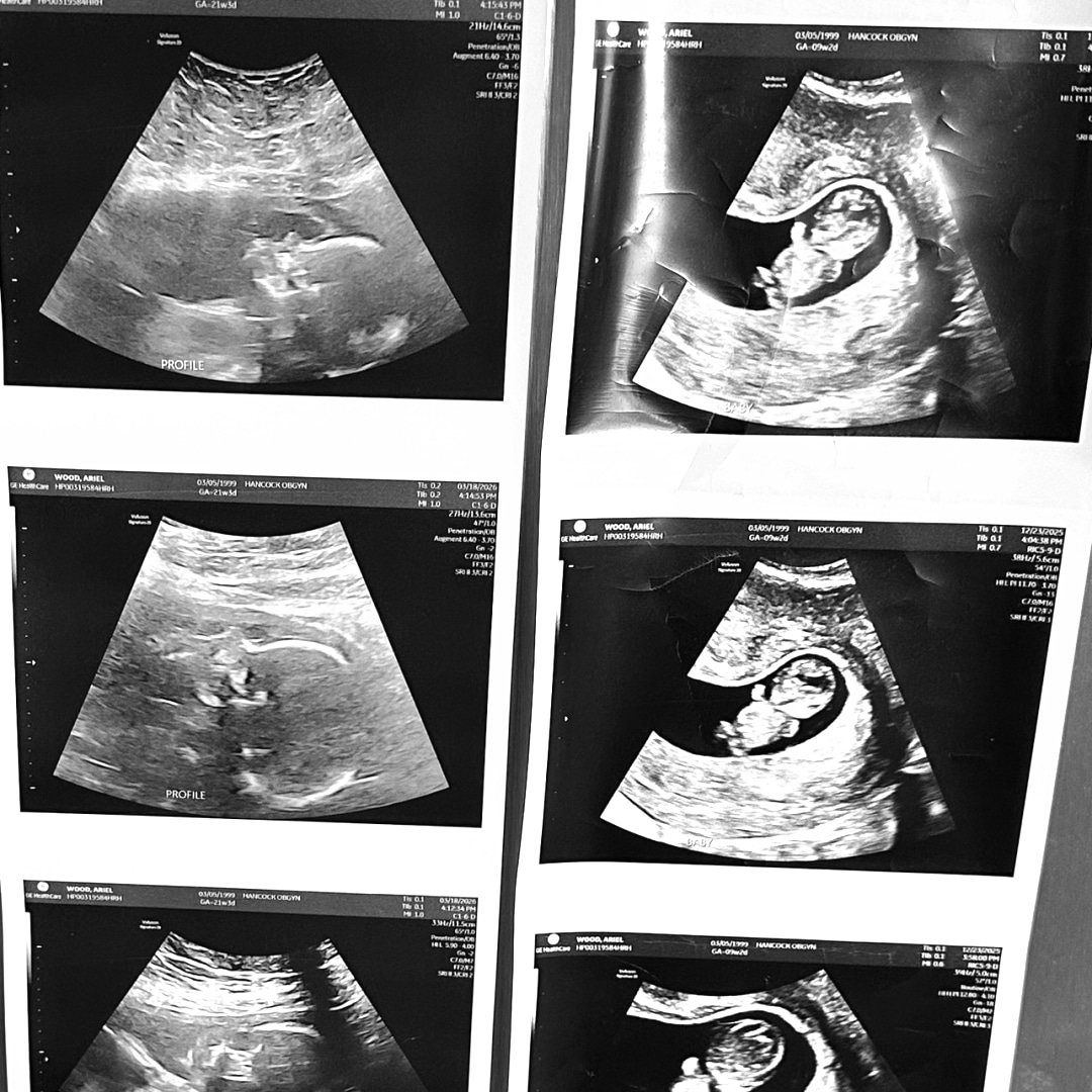 Photo shared by Ariel for their Babylist baby registry.