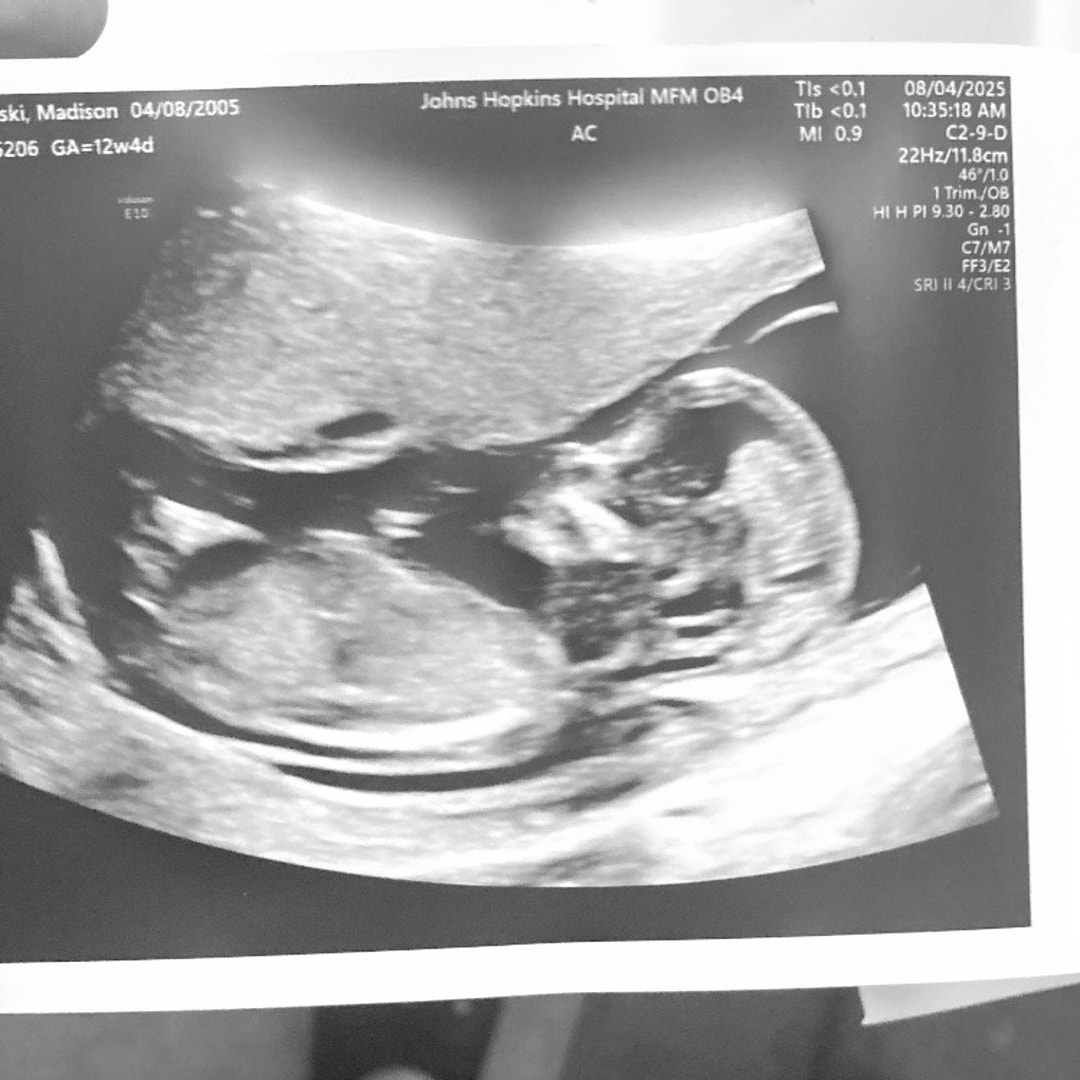 Photo shared by Madison for their Babylist baby registry.