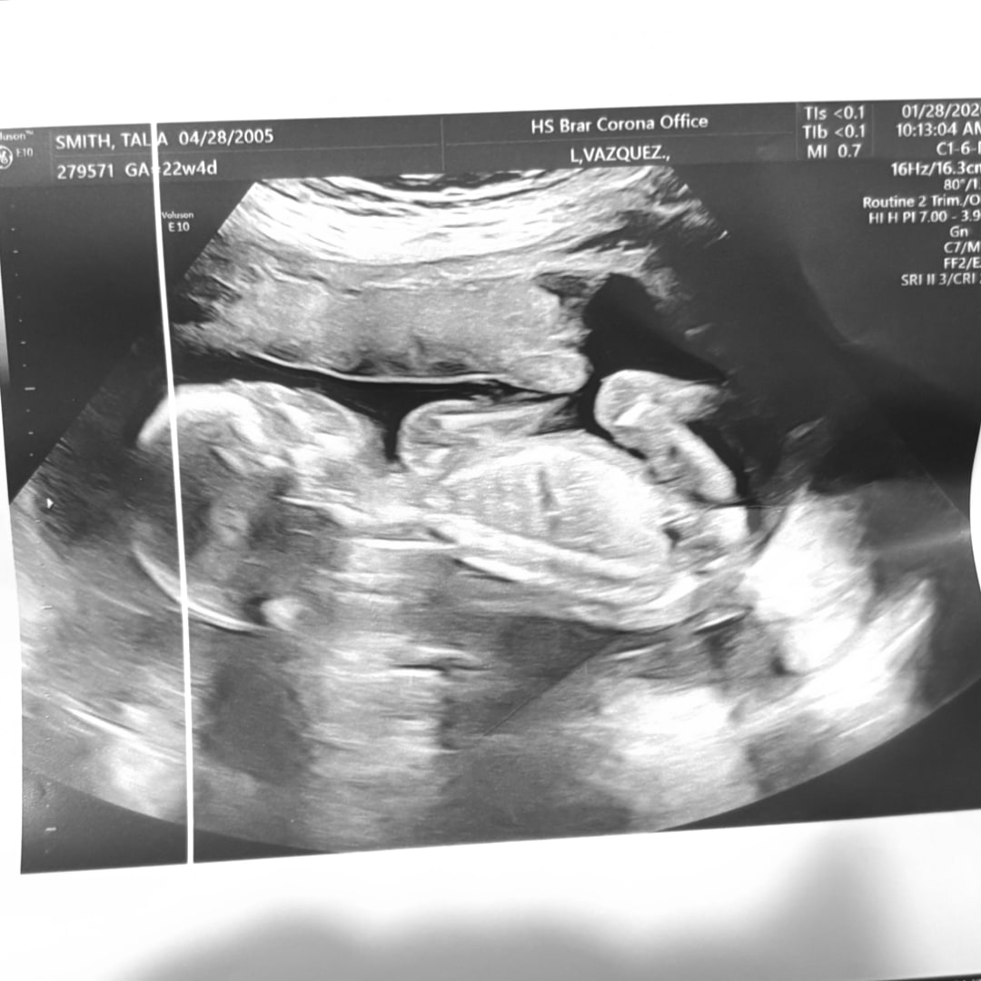Photo shared by Talia for their Babylist baby registry.