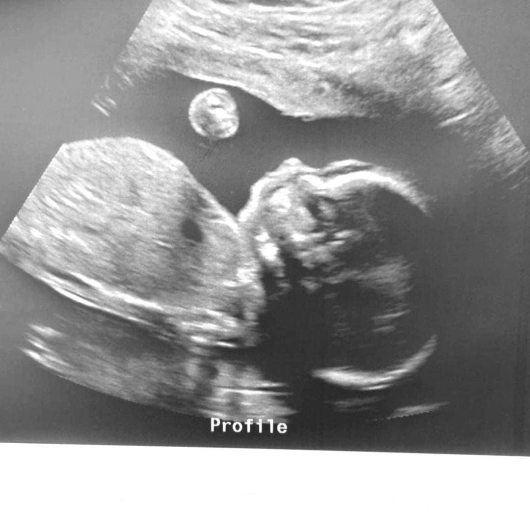 Photo shared by Kayleigh for their Babylist baby registry.