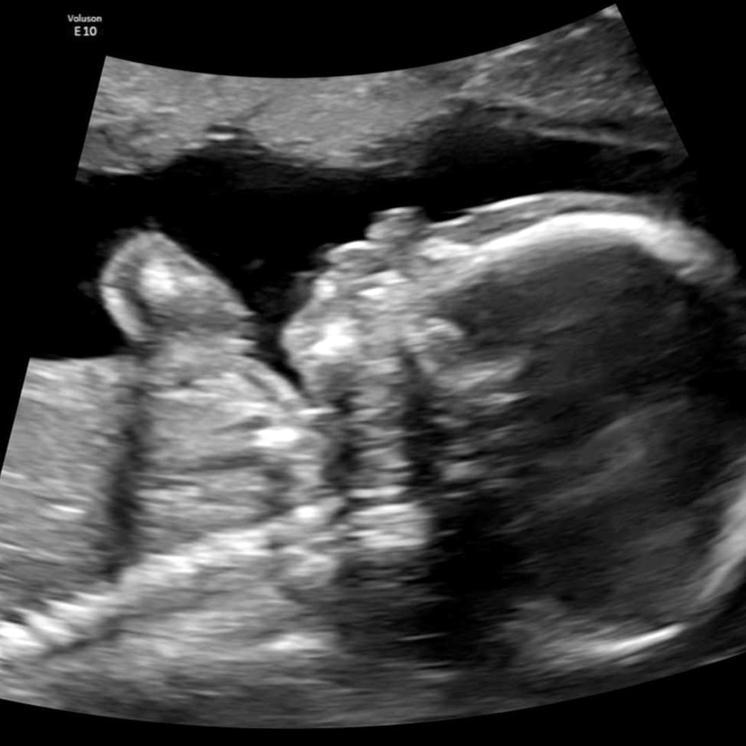 Photo shared by Isabella for their Babylist baby registry.