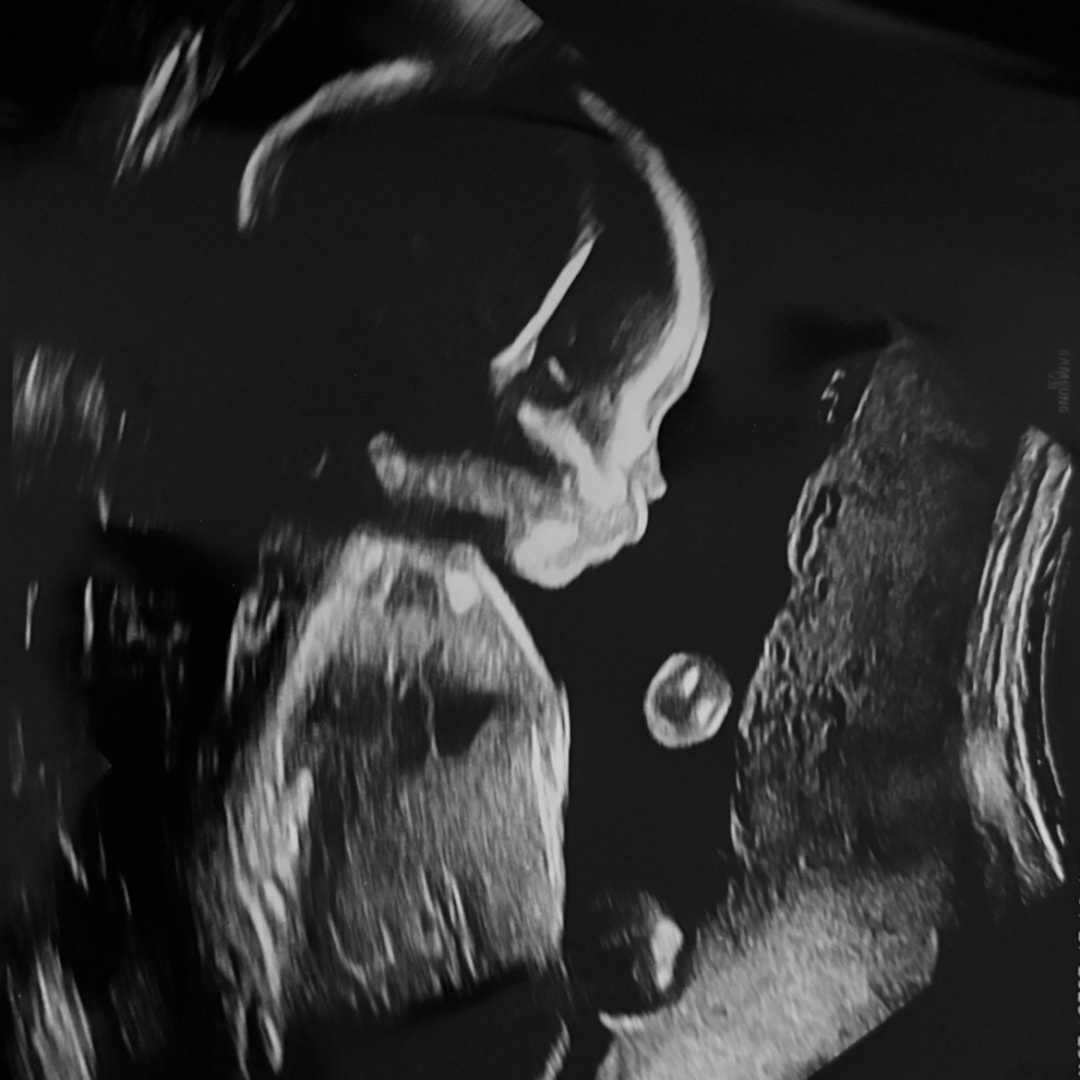Photo shared by Destiny for their Babylist baby registry.