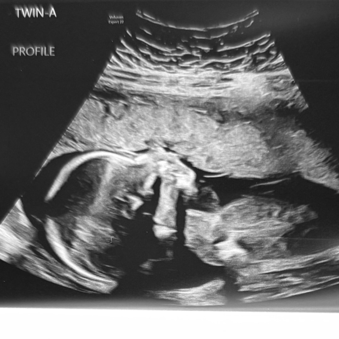 Photo shared by Mari for their Babylist baby registry.