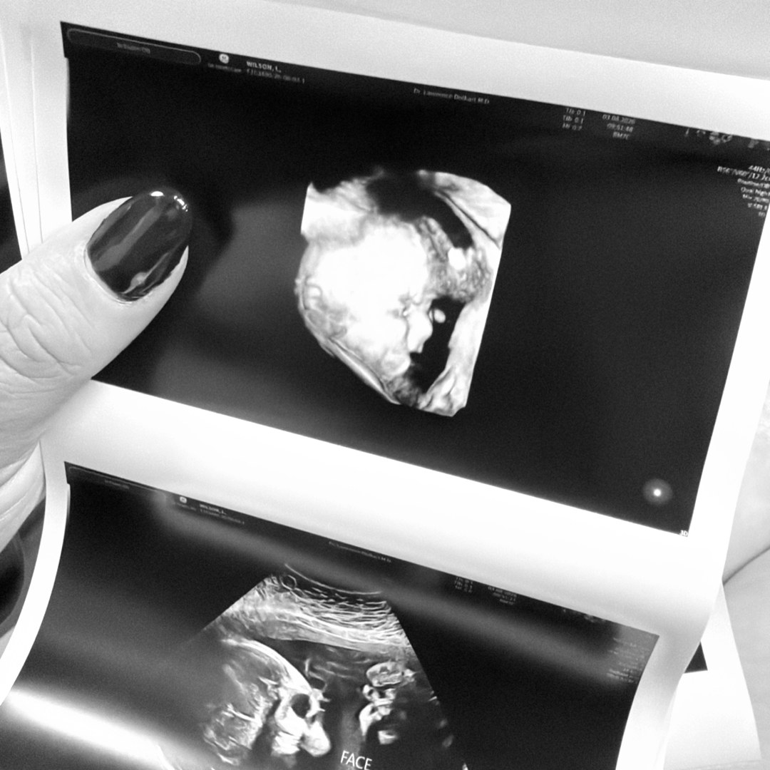 Photo shared by Logan for their Babylist baby registry.