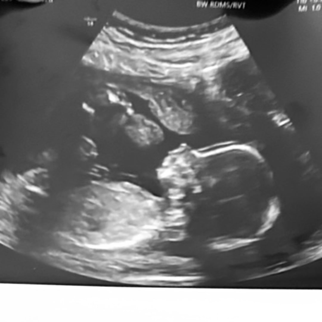 Photo shared by Emily for their Babylist baby registry.