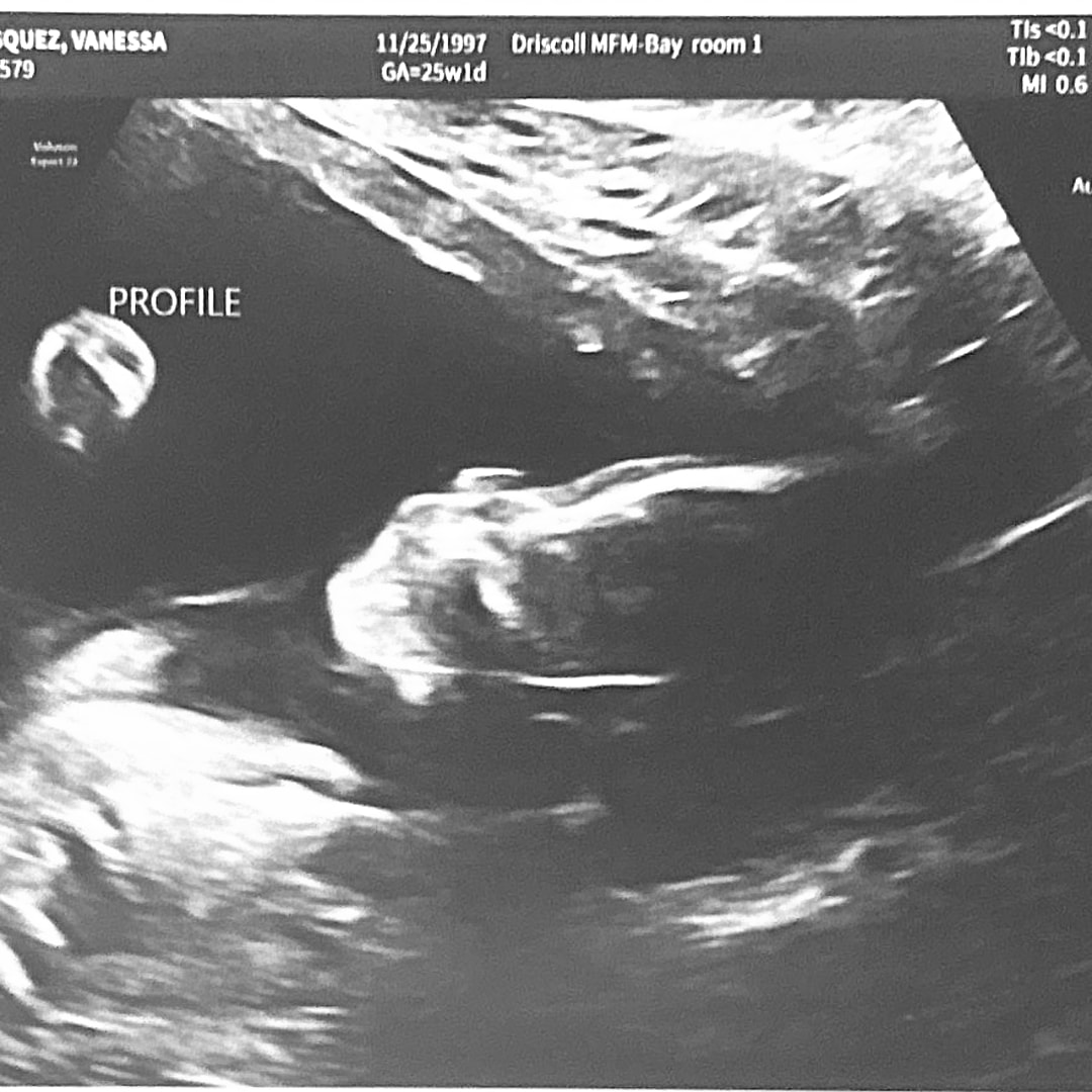 Photo shared by Vanessa for their Babylist baby registry.