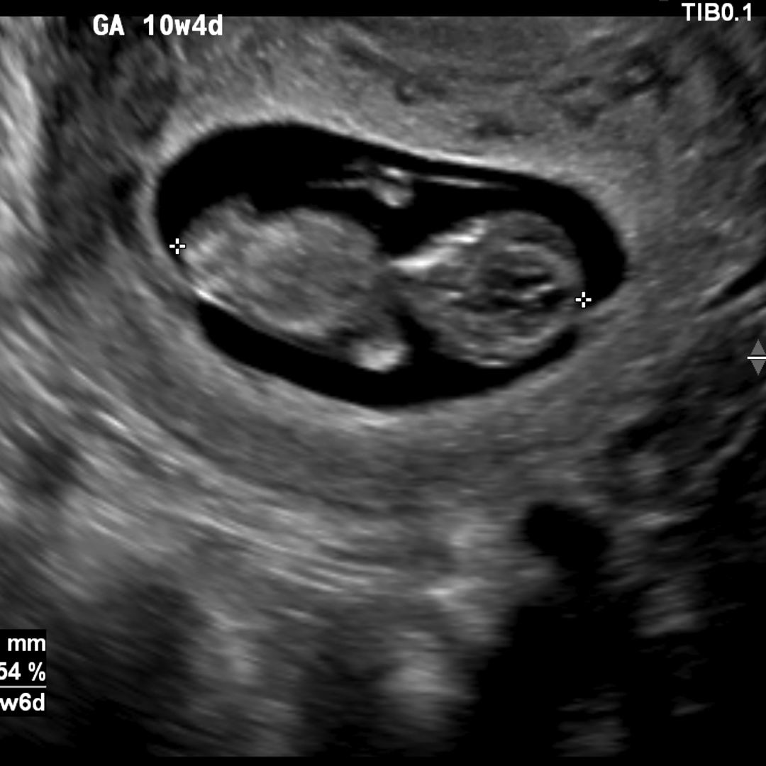 Photo shared by Serena for their Babylist baby registry.