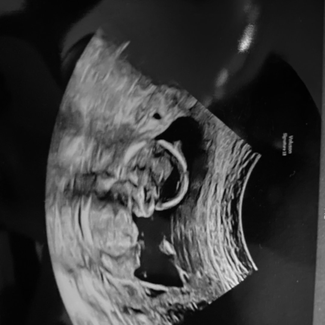 Photo shared by Rebecca for their Babylist baby registry.