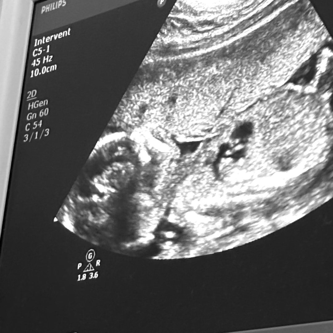 Photo shared by Zakirah for their Babylist baby registry.