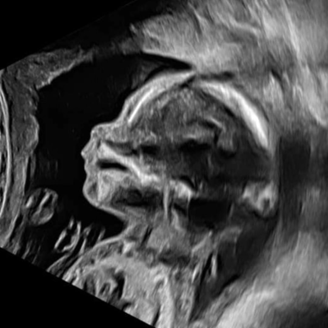 Photo shared by Darrien for their Babylist baby registry.