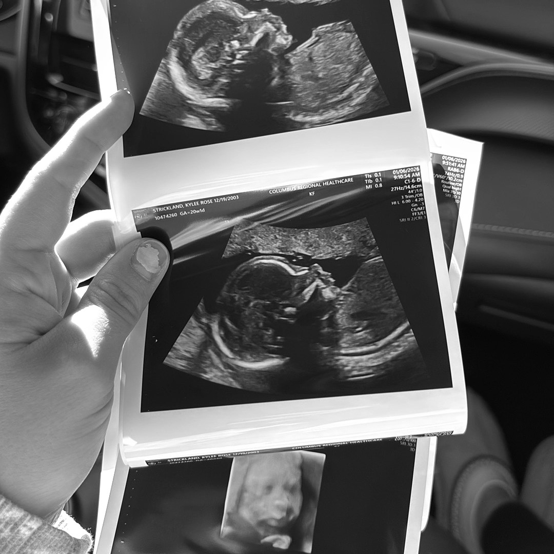 Photo shared by Kylee for their Babylist baby registry.