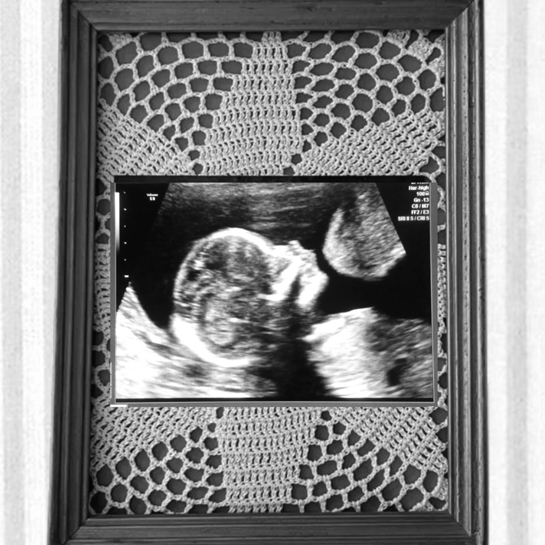 Photo shared by Sara for their Babylist baby registry.