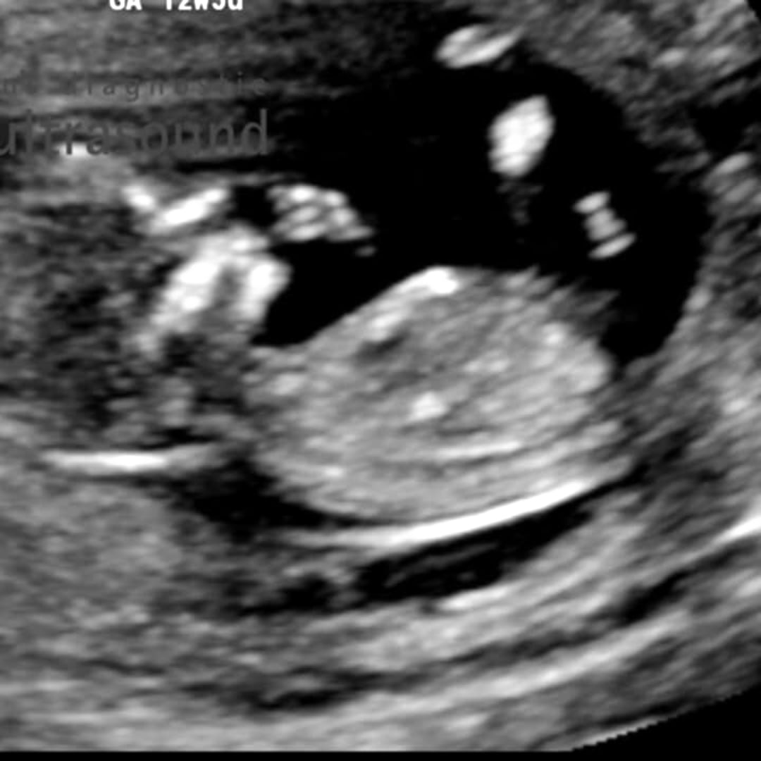 Photo shared by Caitlin for their Babylist baby registry.