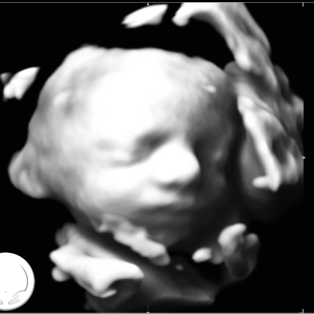 Photo shared by Caitlen for their Babylist baby registry.